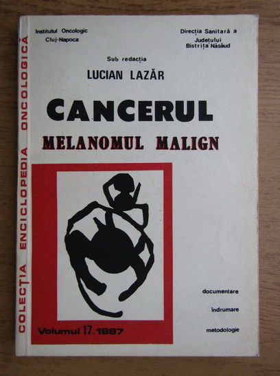 Anticariat: Lucian Lazar - Cancerul. Melanomul malign