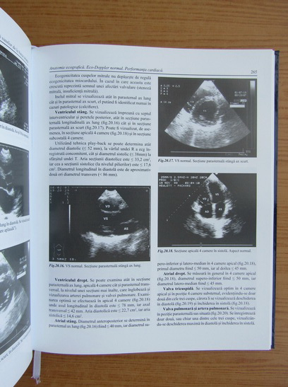 Mispend Steadily coat Radu Ion Badea - Tratat de ultrasonografie clinica (volumul 2) - Cumpără