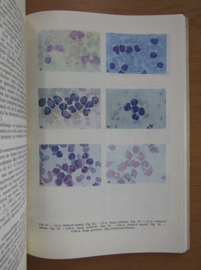 Dumitru Micu - Celulele leucemice. Citologie comparata