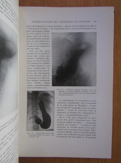 R. Ledoux Lebard - Manuel de radiodiagnostic clinique (volumul 2)