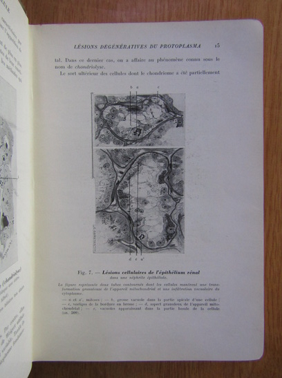 G. Roussy - Precis d'anatomie pathologique (volumul 1)