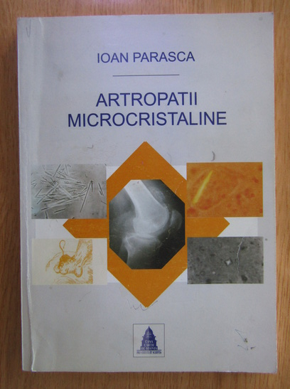 Anticariat: Ioan Parasca - Artropatii microcristaline