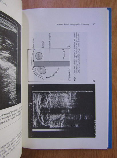 John W. Seeds - Practical Obstetrical Ultrasound