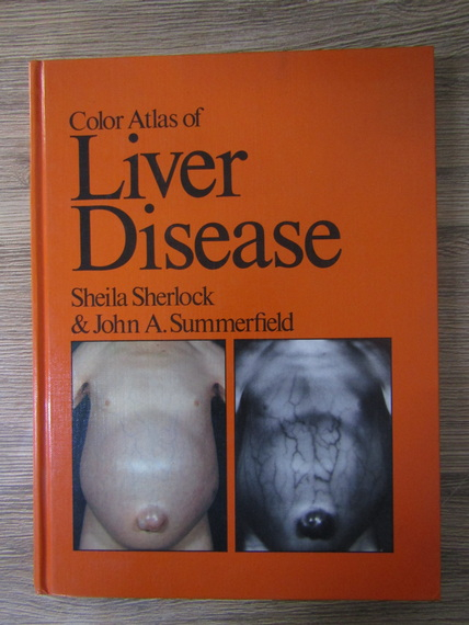 Anticariat: Sheila Sherlock - Color atlas of liver disease