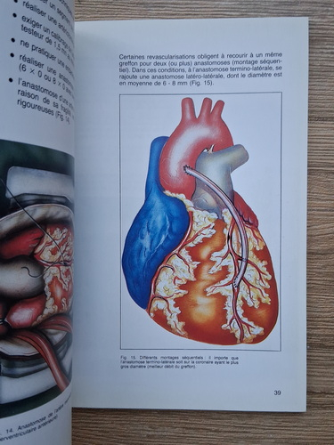 Ph. Gorny - L'etat actuael de la chirurgie coronorarienne