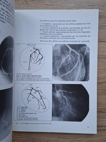 Ph. Gorny - L'etat actuael de la chirurgie coronorarienne