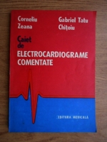 Gabriel Tatu Chitoiu - Caiet de electrocardiograme comentate