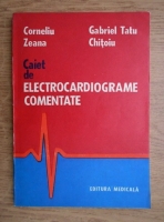 Corneliu Zeana - Caiet de electrocardiograme comentate