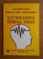 Tudor Dimitrie Lupescu - Electromiografie potentiale evocate