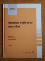 Immediate single-tooth restoration
