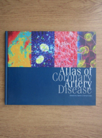 Andrew J. Stewart Coats - Atlas of coronary artery disease