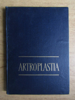 Anticariat: N. Robanescu - Artroplastia