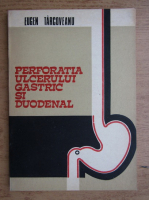 Eugen Tarcoveanu - Perforatia ulcerului gastric si duodenal