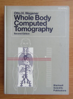 Otto H. Wegener - Whole Body Computed Tomography