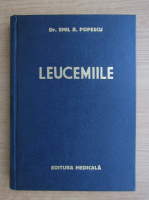 Emil Popescu - Leucemiile