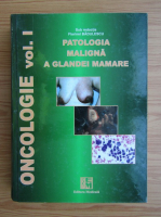 Florinel Badulescu - Oncologie, volumul 1. Patologia maligna a glandei mamale