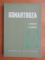 Aurel Denischi - Gonartroza