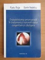Radu Boja - Endopielotomia anterograda in tratamentul hidronefrozelor congenitale si castigate