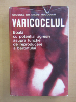 Iacob Moldovan - Variocel. Boala cu potential agresiv asupra functiei de reproducere a barbatului