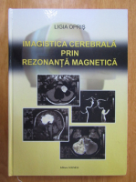 Ligia Opris - Imagistica cerebrala prin rezonanta magnetica
