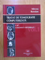 Mircea Buruian - Tratat de tomografie computerizata, volumul 1. Cap, coloana vertebrala