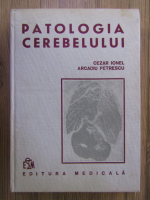 Anticariat: Cezar Ionescu, Arcadiu Petrescu - Patologia cerebelului