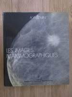 Anticariat: A. Willemin - Mammographic appearances. Les images mammographiques