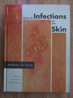 Anthony du Vivier - Atlas of infections of the skin