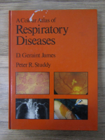 Anticariat: D. Geraint James - Respiratory diseases