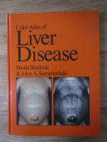 Sheila Sherlock - Color atlas of liver disease
