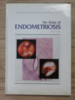 Robert W. Shaw - An atlas of endometriosis