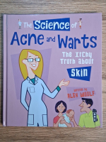 Anticariat: Alex Woolf - The science of acne and warts. The itchy truth about skin