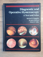 Michael S. Baggish - Diagnostic and operative hysteroscopy. A text and atlas