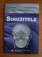 Maria Beuran - Sinuzitele 