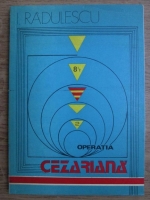 Ion Radulescu - Operatia cezariana